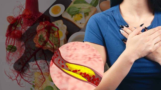 Cholestérol élevé : prudence avec cet ingrédient omniprésent dans notre alimentation !